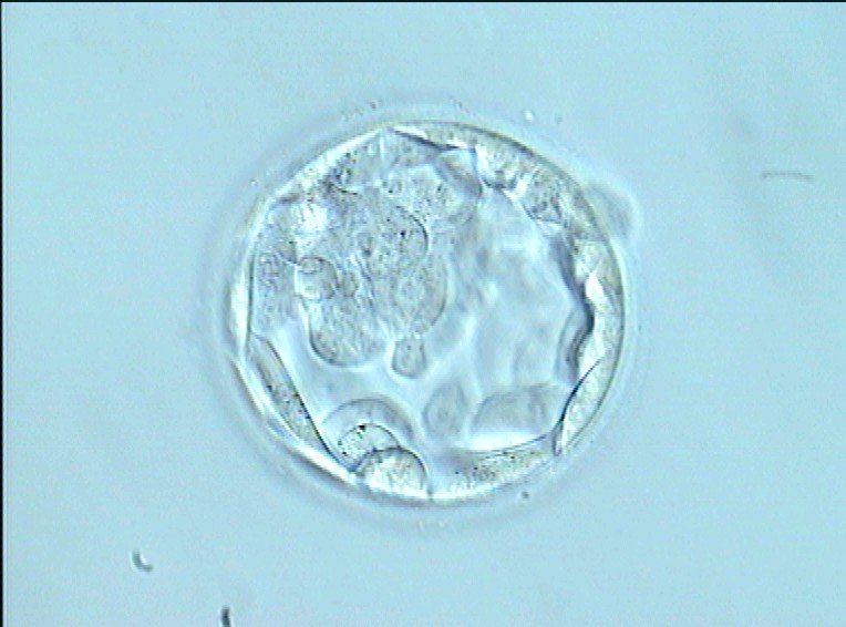 Blastocyst, advantages of a transfer on day 4 or 5