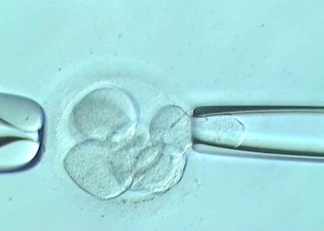 Effetti della vitrificazione sui blastocisti sottoposti a biopsia