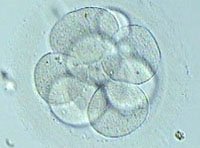 International publication: The paternal effect of chromosome translocation carriers observed from meiotic segregation in embryos