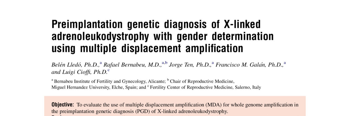 Preimplantation genetic diagnosis of X-linked adrenoleukodystrophy with gender determination using multiple displacement amplification