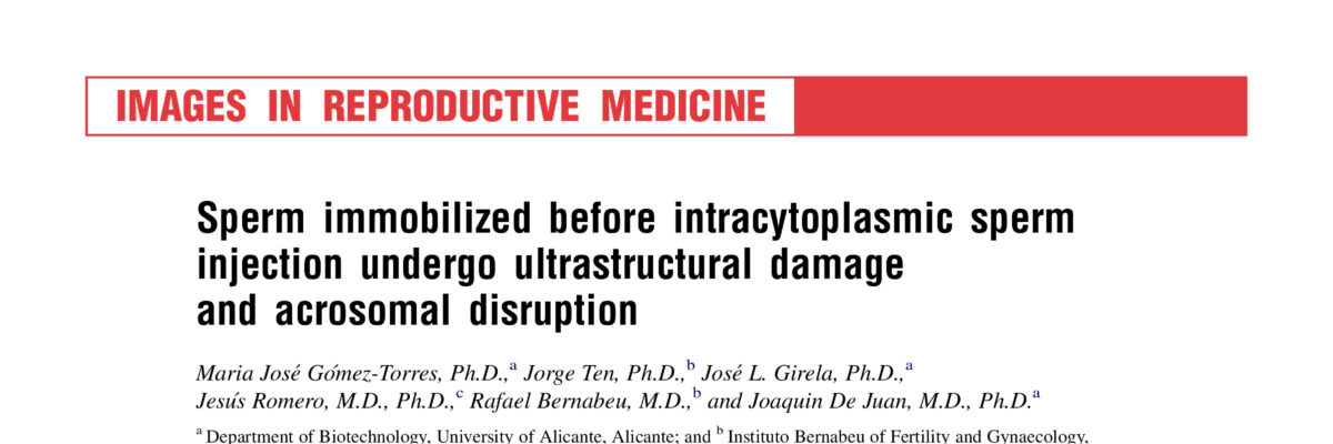 Sperm immobilized before intracytoplasmic sperm injection undergo ultrastructural damage and acrosomal disruption