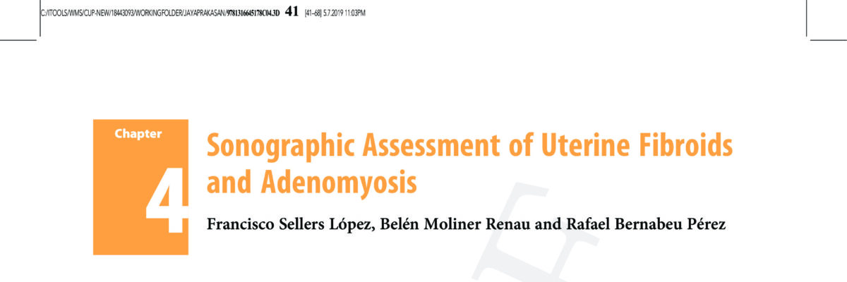 Sonographic Assessment of Uterine Fibroids and Adenomyosis