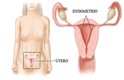 endometrium2