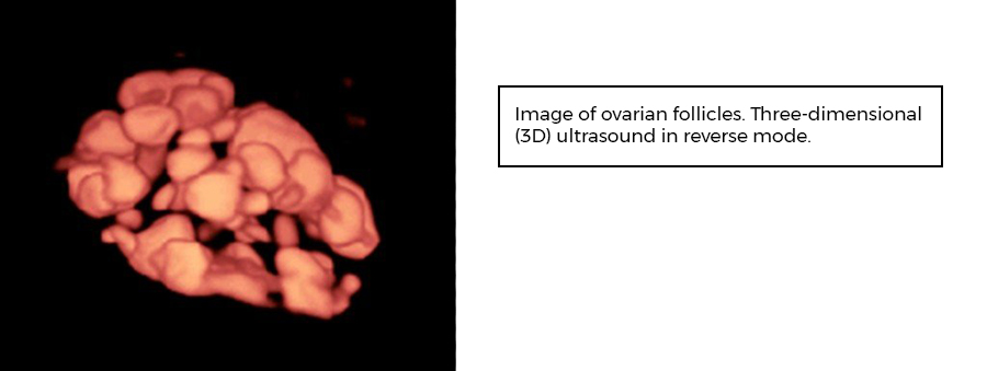 Ovarian follicles. Instituto Bernabeu