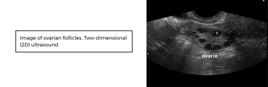 Ovarian follicles. Instituto Bernabeu