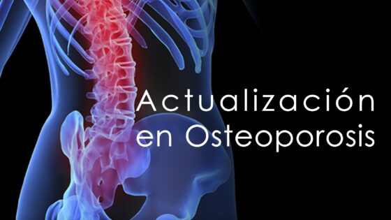 Inscripción disponible para la próxima jornada de actualización en osteoporosis