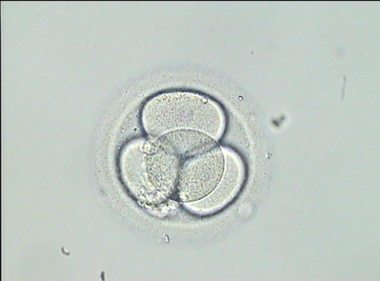 Erste Studie über die Qualitätsanalyse von Embryonen in Zusammenhang mit der Erscheinung von angeborenen Defekten