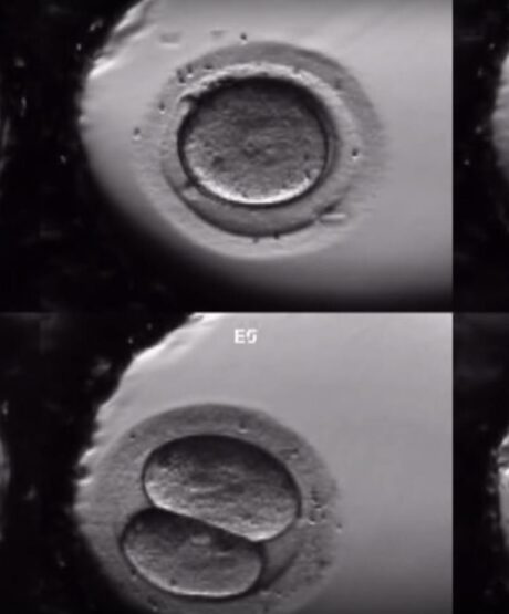 Time-lapse incubateurs 