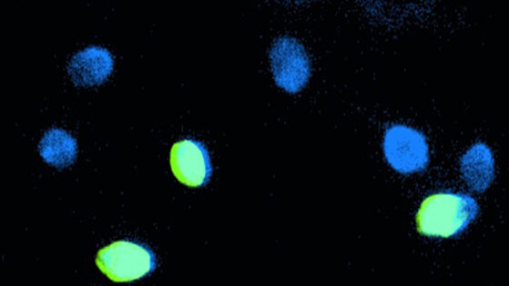 Fragmentation de l’ADN spermatique : TUNEL