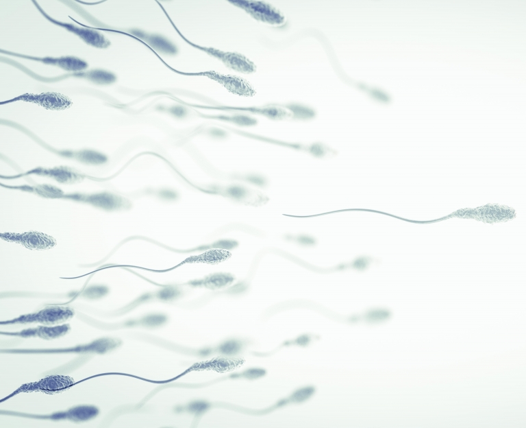 What is hypospermia? How can it be detected? How does it affect my fertility?