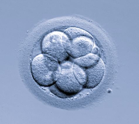 What are the advantages of embryo vitrification? - Instituto Bernabeu