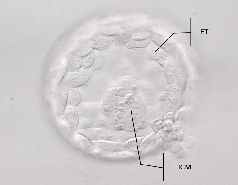 Instituto Bernabeu Forschung: Die Qualität der internen Zellmasse und des Trophectoderms sagen den Prozentsatz von embryonaler Aneuploidie voraus