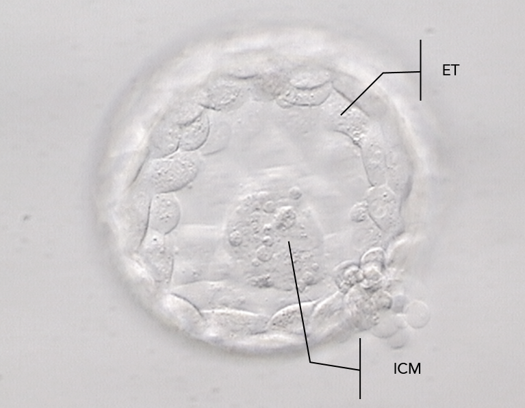 Instituto Bernabeu Research: Internal cellular mass and trophectoderm quality indicate embryo aneuploidy percentage.