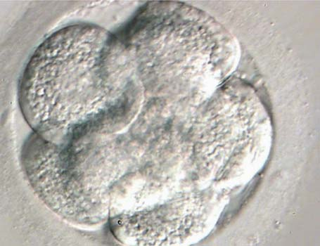 Instituto Bernabeu Research: Chromosomal study of embryos which divide more rapidly on day 3.