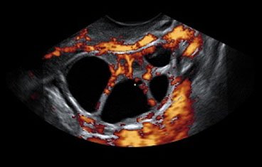 Ricerca IB: corretta maturazione finale degli ovociti