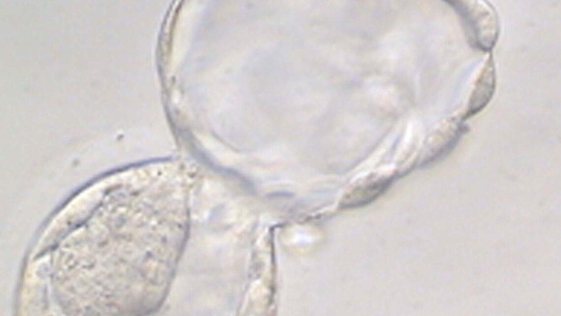 Investigación IB: Efecto de la posición de la masa celular interna en la implantación del embrión