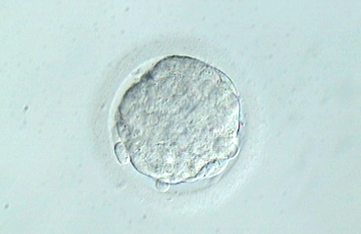 Los embriones portadores de mosaicismo cromosómico pueden dar lugar a embarazo con buenas tasas de éxito. Investigación IB. ESHRE 2016