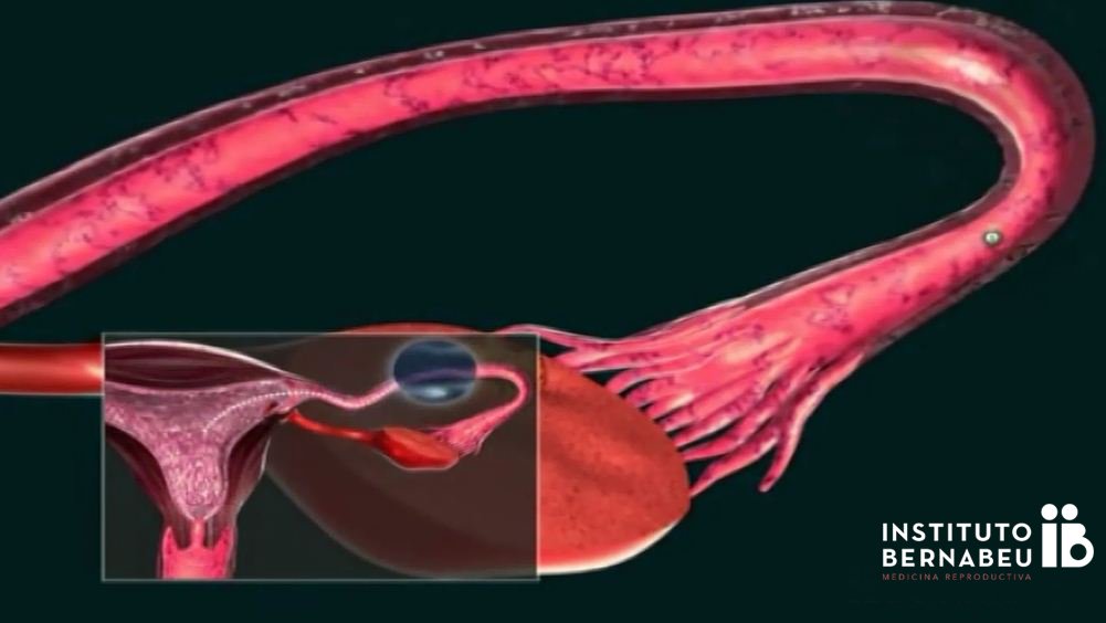 IB research: “Ovarian induction in egg donors: Corifollitropin alfa versus urinary FSH”