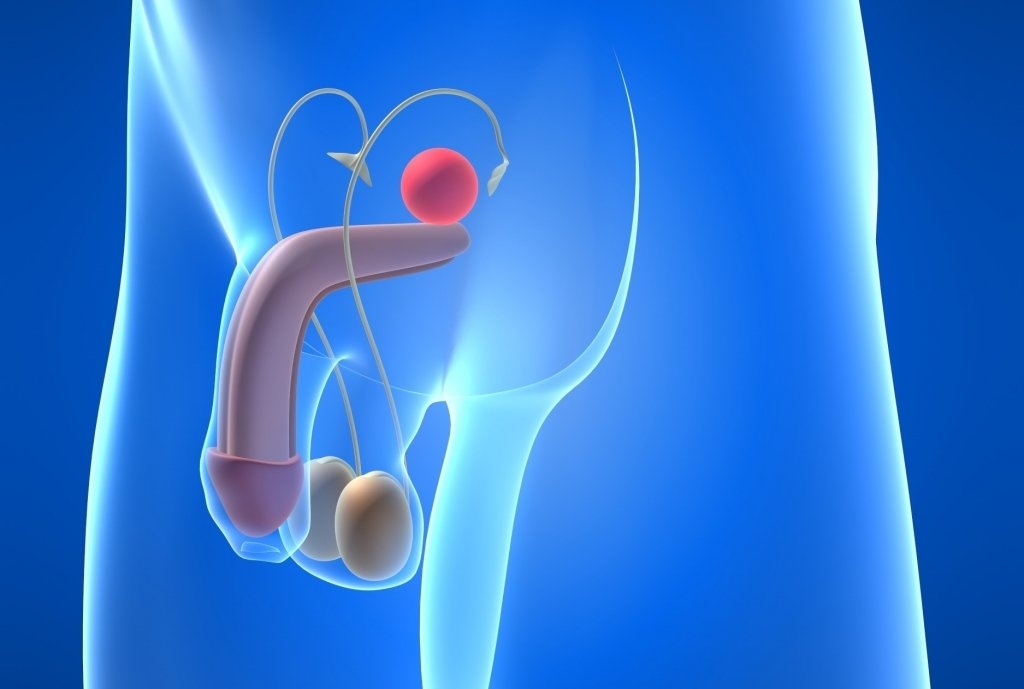 Teratozoospermia and male infertility - Instituto Bernabeu