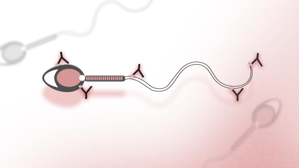 Anti-Spermien-Antikörper (ASA): was ist Mythos und was ist Realität?