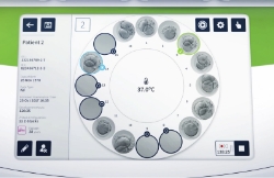 Culturing the embryos
