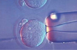 ICSI (Intracytoplasmic Sperm Injection)