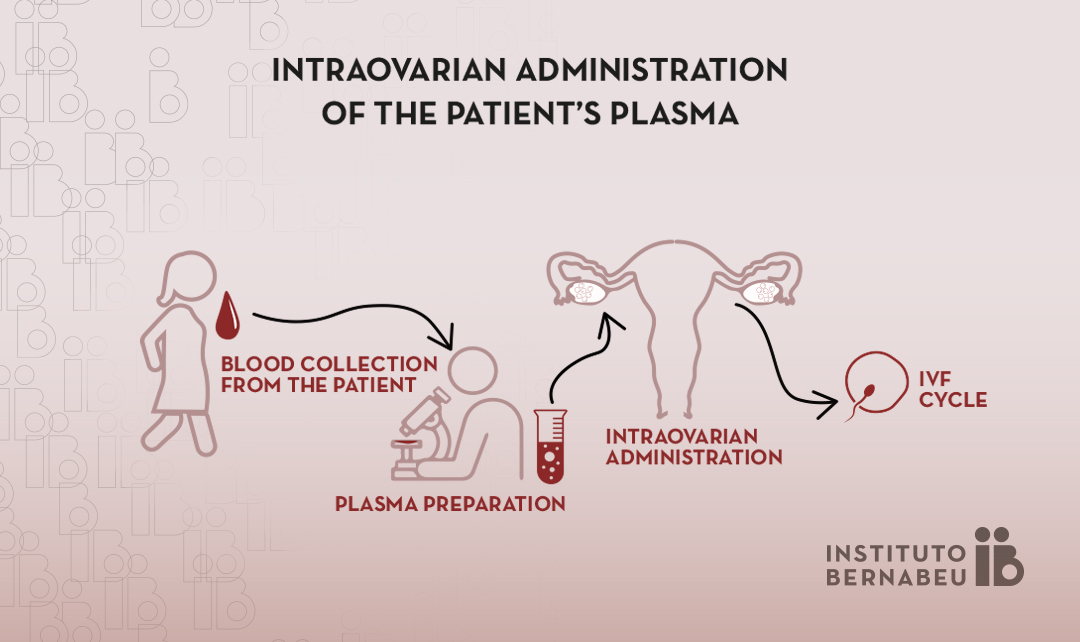 Use of platelet rich plasma (PRP) in low ovarian reserve