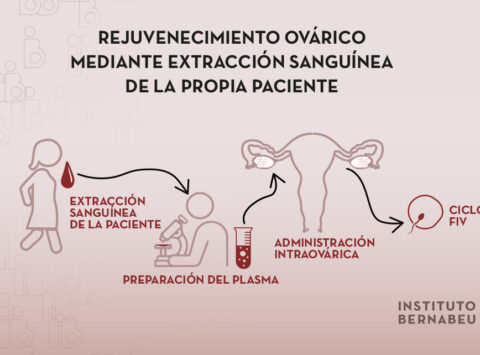 Uso de plasma rico en plaquetas (PRP) en baja reserva ovárica