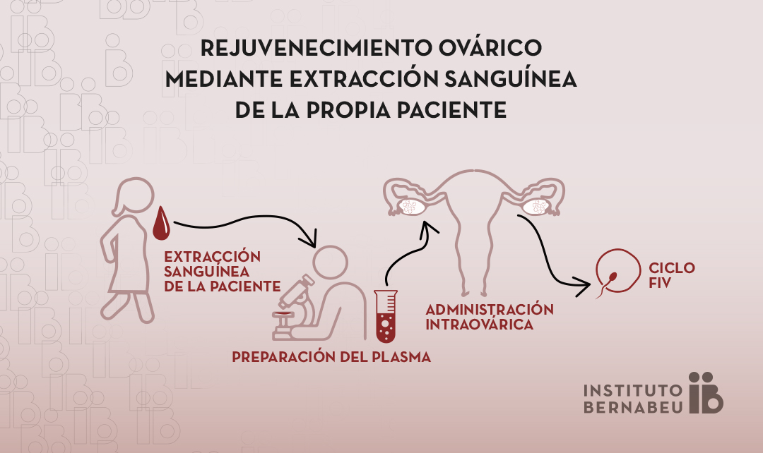 Uso de plasma rico en plaquetas (PRP) en baja reserva ovárica