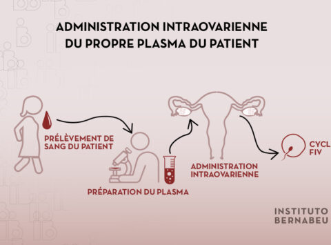 Utilisation du plasma riche en plaquettes (PRP) en cas de faible réserve ovarienne