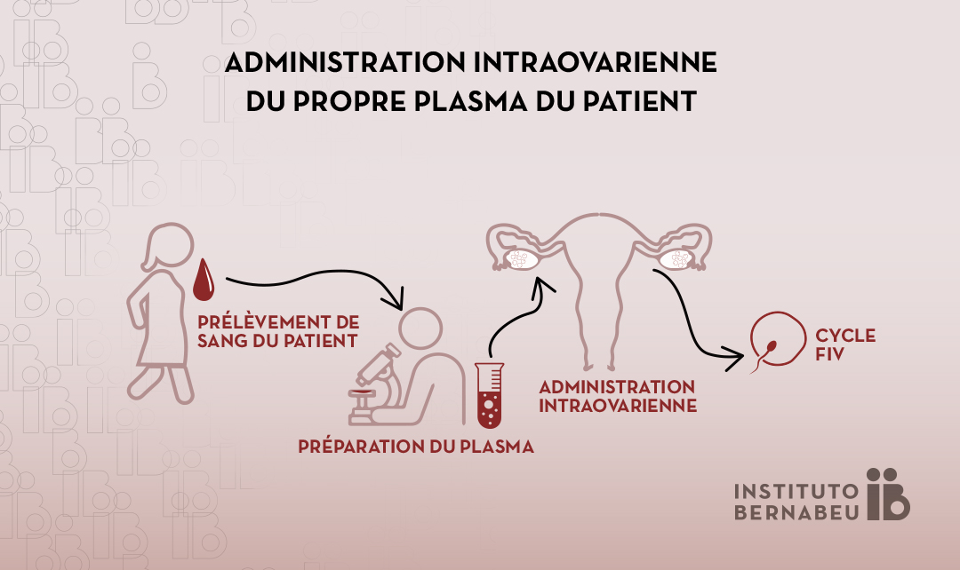 Utilisation du plasma riche en plaquettes (PRP) en cas de faible réserve ovarienne