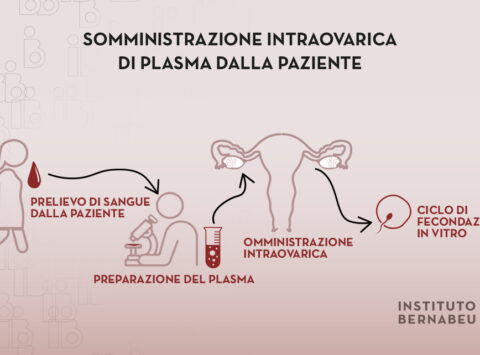 Utilizzo del plasma ricco di piastrine (PRP) nella bassa riserva ovarica