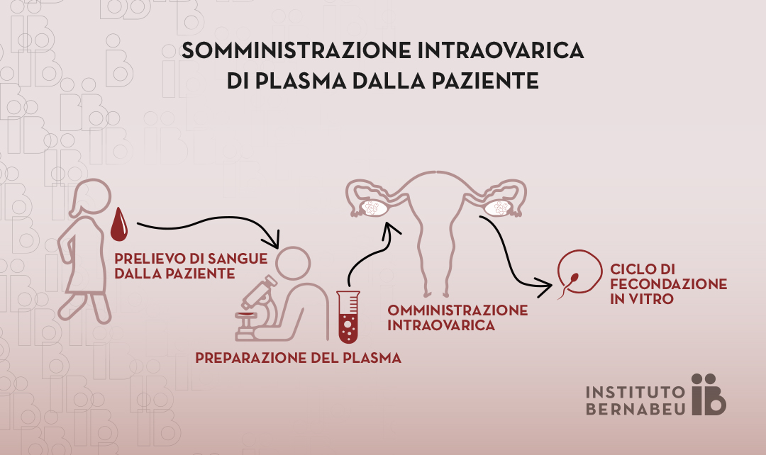 Utilizzo del plasma ricco di piastrine (PRP) nella bassa riserva ovarica