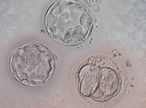 Décongélation des embryons : Tout ce que vous devez savoir sur la dévitrification