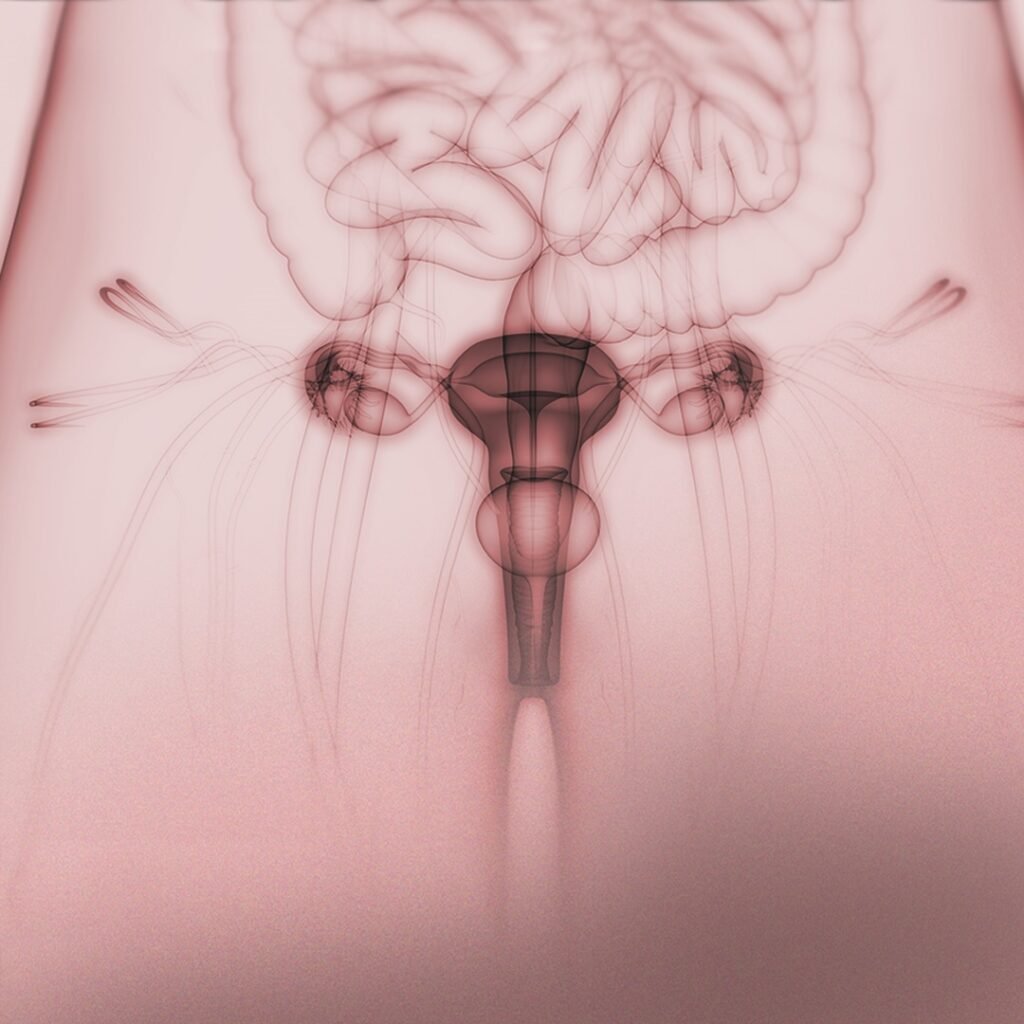 ¿Qué es la cervicitis? Causas, síntomas, diagnóstico y tratamiento - Instituto Bernabeu