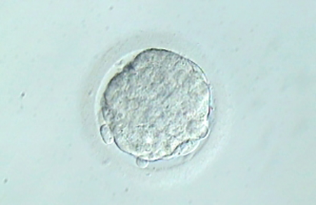 Embryo transfer on day 4 – why not?