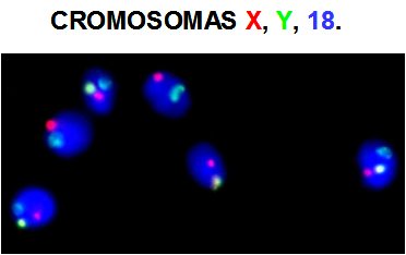 Che informazioni ci fornisce un FISH in spermatozoi?