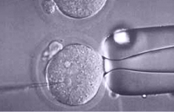 Récolte d’ovocytes de l’ovodonneuse