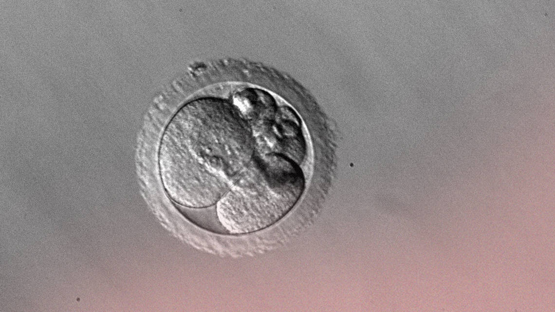 An Instituto Bernabeu investigation presented at ESHRE concludes that Clinical outcomes of mosaic embryos are similar between young and older women