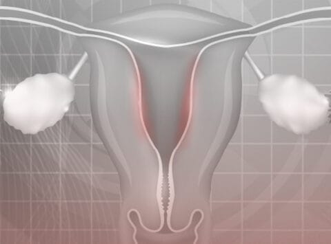 Die internationale Fachzeitschrift Obstetrics & Gynecology and Reproductive Biology veröffentlicht eine Studie des Instituto Bernabeu über das vaginale Mikrobiom als Diagnoseverfahren für chronische Endometritis