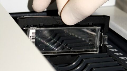 Nutzen von PGS / PGT-A / CCS (vollständiges Chromosomen-Screening) bei wiederholten Fehlgeburten