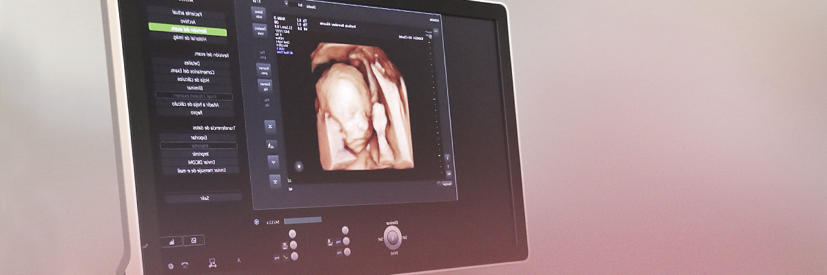 3D-4D Ultrasound