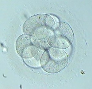 What became of my embryos? Haven’t I got embryos to freeze?