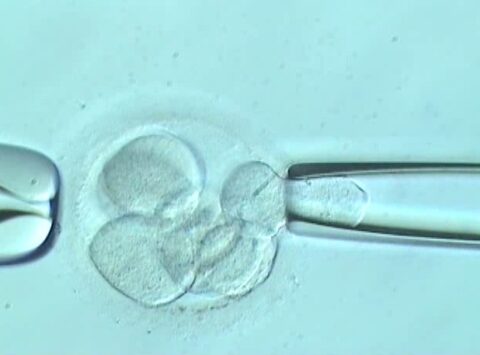 Worin besteht die Biopsie des Embryos?