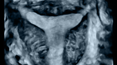 Preparación de la cavidad endometrial para recibir al embrión