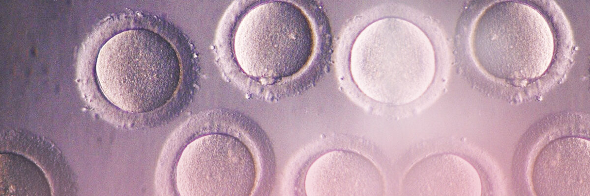 Don d’ovocytes, traitement de FIV avec des ovules donnés