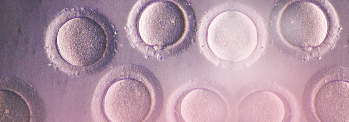 Как улучшить яйцеклетки после 40. Ооциты 3d. Банк доноров яйцеклеток с фото. Красивые картинки зрелое яйцо ооцит. Эко + ооциты ОМС донорские.