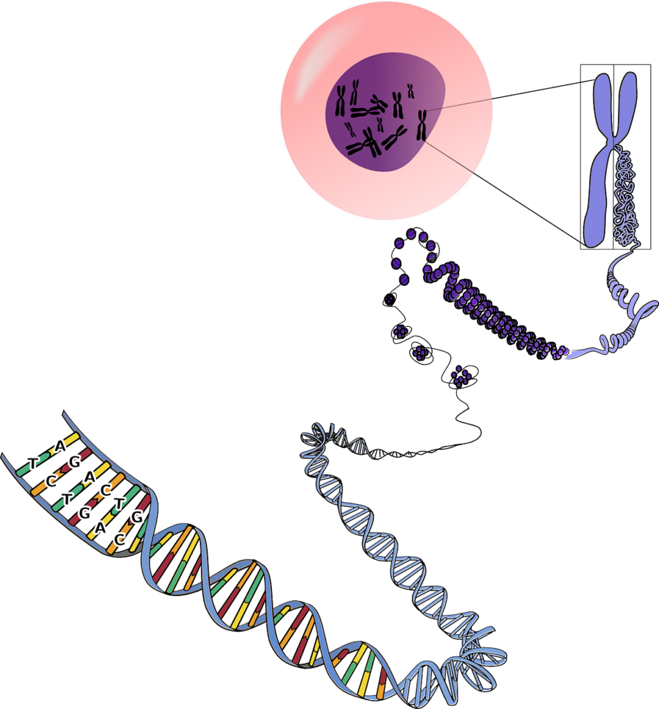 Swyer syndrome or pure gonadal dysgenesis - Instituto Bernabeu