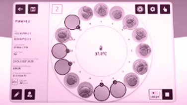 Embryo cultuur