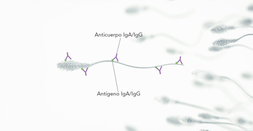 Antisperm antibodies (AAE) Instituto Bernabeu